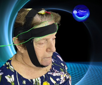 TDCS